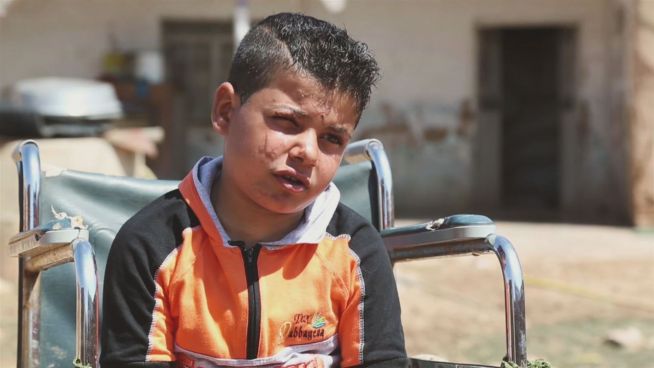 Minenexplosion: Dieser kleine Junge verlor sein Bein