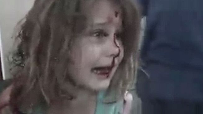 Blutüberstömt: Weinendes Mädchen in Syrien